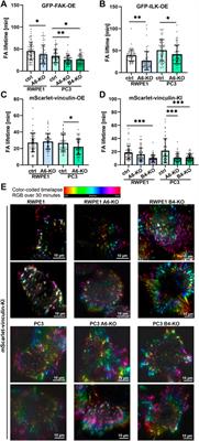 Loss of α6β4 Integrin-Mediated Hemidesmosomes Promotes Prostate Epithelial Cell Migration by Stimulating Focal Adhesion Dynamics